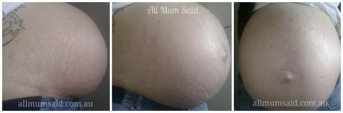 pregnancy | not so joys of pregnancy