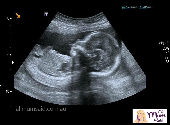 How to prepare for baby when you don't know the gender